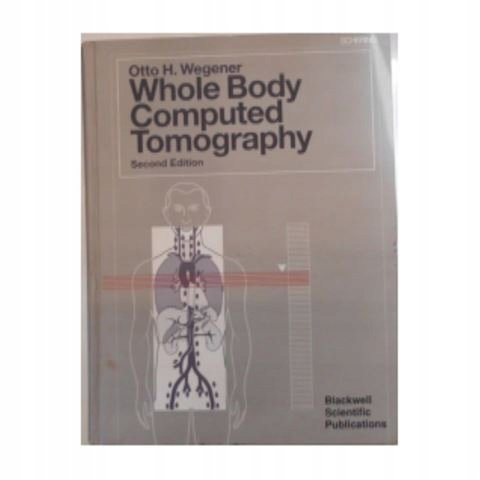 Whole Body Computed Tomography - Baralo Ottonello Marta | Książka w Empik