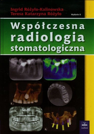 Współczesna radiologia stomatologiczna Różyło-Kalinowska Ingrid, Różyło Teresa Katarzyna