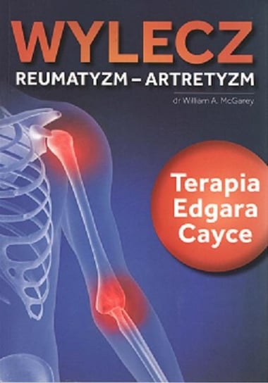 Wylecz reumatyzm-artretyzm. Terapia Edgara Cayce Mcgarey William A.