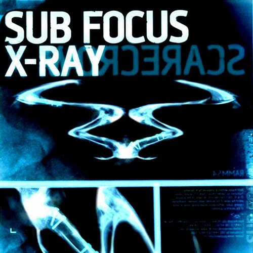 X Ray Sub Focus
