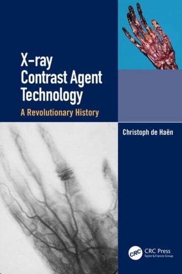 X-ray Contrast Agent Technology: A Revolutionary History Christoph de Haen