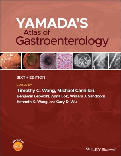Yamadas Atlas of Gastroenterology Opracowanie zbiorowe