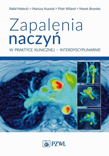 Zapalenia naczyń w praktyce klinicznej interdyscyplinarnie - ebook mobi Wiland Piotr, Marek Brzosko, Rafał Małecki, Mariusz Kusztal