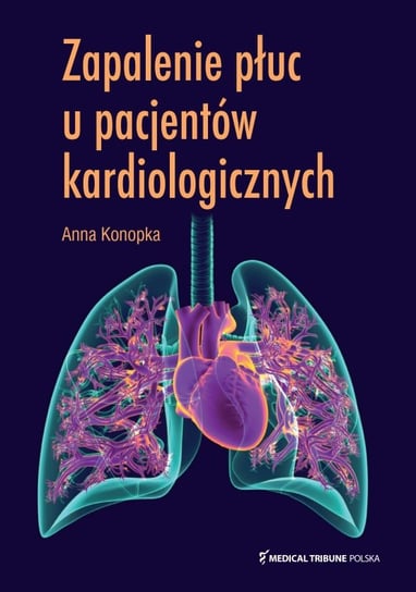 Zapalenie płuc u pacjentów kardiologicznych Anna Konopka