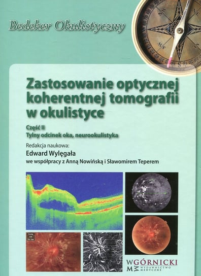 Zastosowanie optycznej koherentnej tomografii w okulistyce. Część 2. Tylny odcinek oka, neurookulistyka Opracowanie zbiorowe