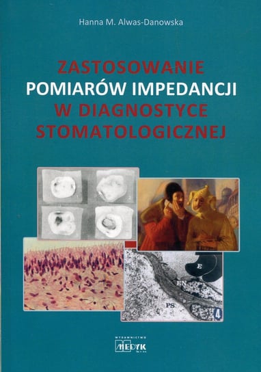 Zastosowanie pomiarów impedancji w diagnostyce stomatologicznej Alwas-Danowska Hanna M.