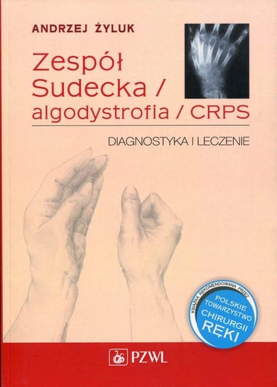 Zespół Sudecka / algodystrofia / CRPS. Diagnostyka i leczenie - ebook epub Żyluk Andrzej