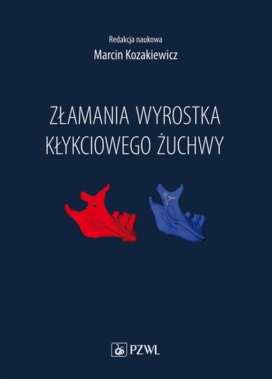 Złamania wyrostka kłykciowego żuchwy Kozakiewicz Marcin