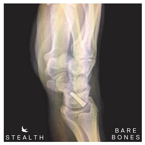 Bare Bones Stealth