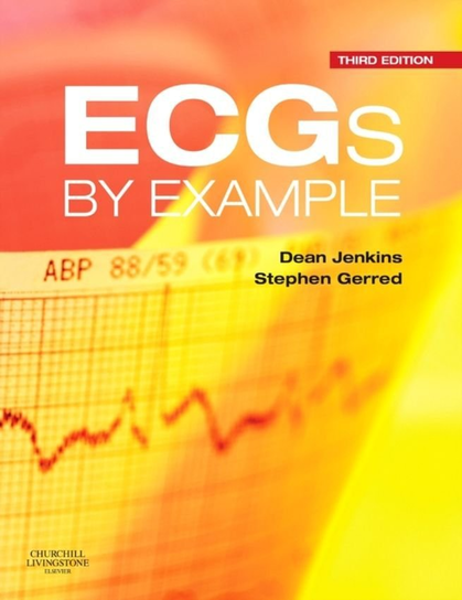 Ecgs By Example Jenkins Dean
