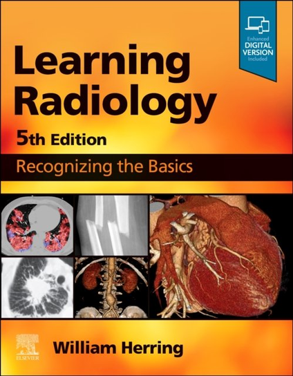 Learning Radiology Herring William