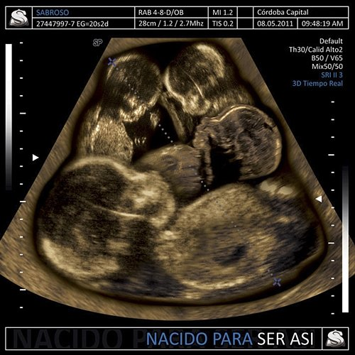 Nacido para Ser Así Sabroso
