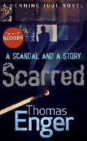 Scarred Enger Thomas