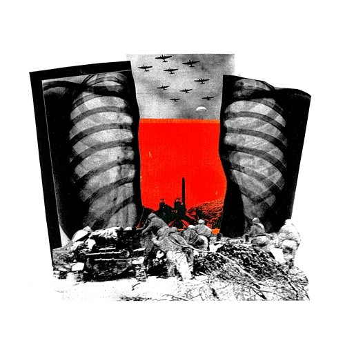 Teeth Remixes Working Men's Club